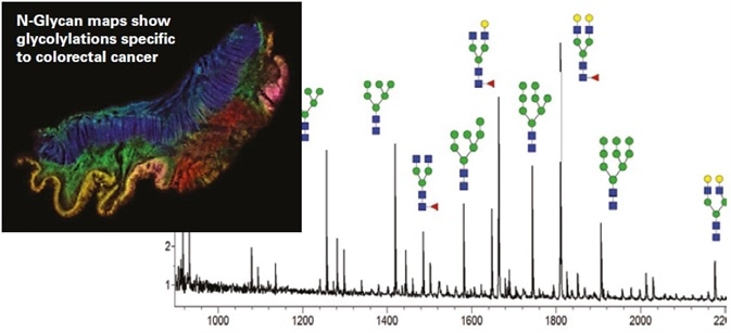 Correlate Protein Glycosylation to Disease