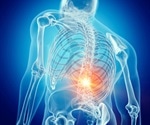 What is Spondyloarthritis?