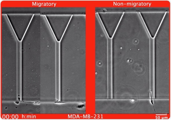New laboratory test has potential to accurately predict spread of breast cancer