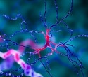 New study defines rapidly progressive dementia