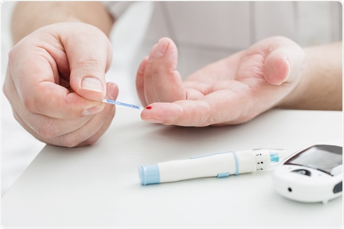 Maya Kruchankova / Shutterstock