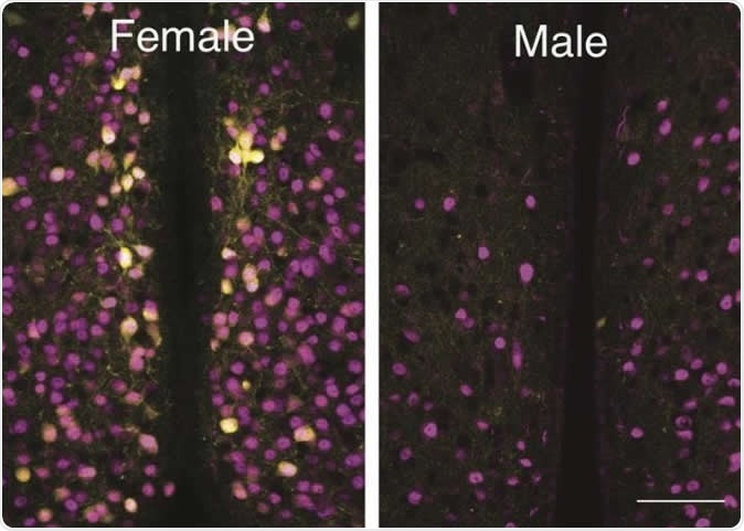 A Louisiana State University biologist and his students have discovered a group of cells that are activated by oxytocin in one area of female mouse brains that are not present in the same area in male mouse brains. Image Credit: Ryoichi Teruyama, LSU