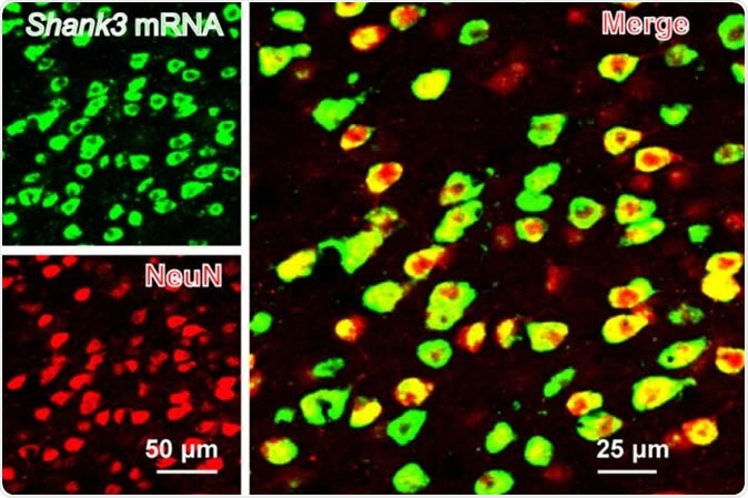 SHANK3 (green) is expressed along with a neural marker (NeuN) in the mouse anterior cingulate cortex. Image Credit: Guoping Feng