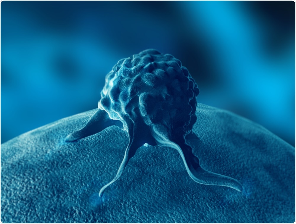 Prostate cancer cell