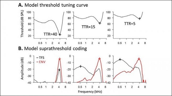 Age and excessive noise have different effects on brain