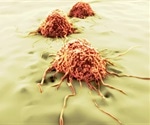 Mathematical model helps quantify metastatic cell behavior