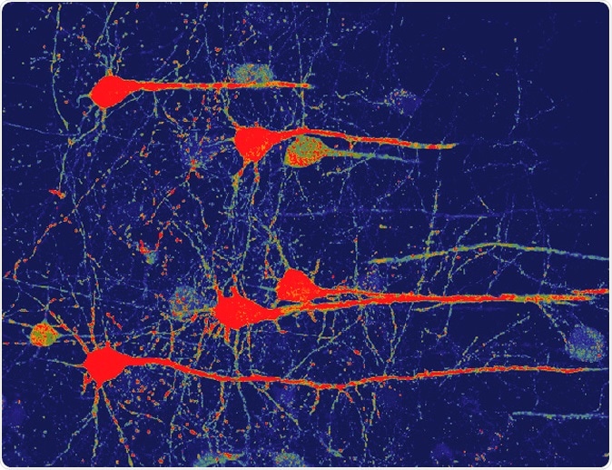 Image of neurons (red) that were converted from glial cells using a new NeuroD1-based gene therapy in a stroke-injured mouse brain. Credit: Chen Laboratory, Penn State