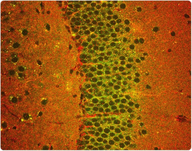 Neurons in the mouse hippocampus