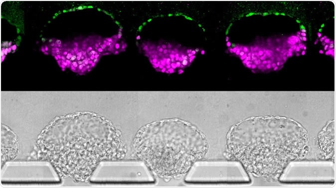 Human embryo-like structures (top) synthesized from human stem cells; they
