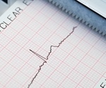 New guidelines for management of a fast heartbeat released