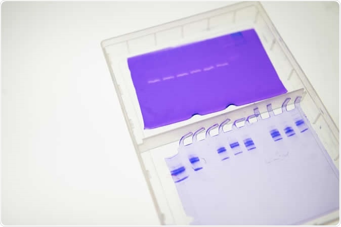 Cathepsins eat away at collagen and elastin in Manu Platt
