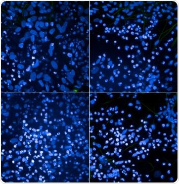 ICC/IF analysis of iPSC-derived cortical neurons from non-demented control sample (L) and individual with a P301L MAPT mutation (R) using StressMarq Clone AH36 pSer202/pThr205 tau antibody (SMC-601) and ThermoFisher Clone AT8 pSer202/pThr205 tau antibody.