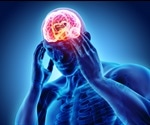 What Foods Can Cause Migraines?
