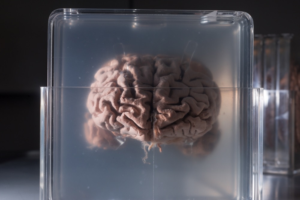 Preserved brain