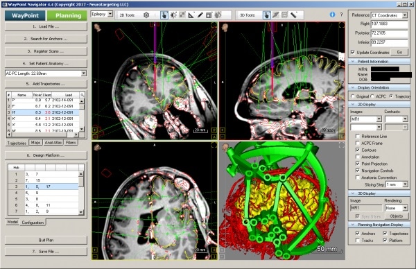 WayPoint™ Navigator Software