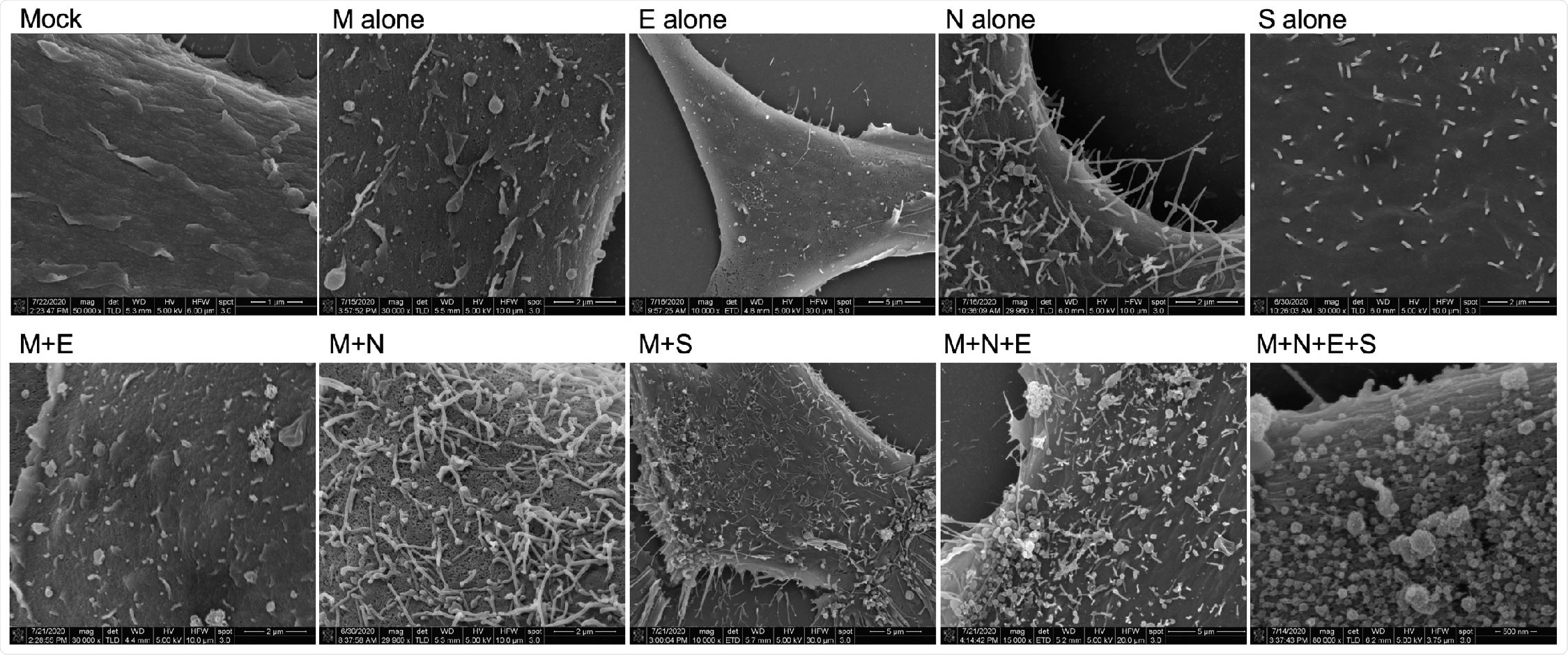 Scanning electron microscopy of viral structural protein transfected cells. HEK293 cells were seeded onto coverslips and transfected individually or in combination with M, N, E, and/or S. Cells were fixed with glutaraldehyde 72-hours post-transfection and kept at 4°C until fixed with osmium tetroxide. Samples were then gradually dehydrated with ethanol and completely dehydrated with a critical point dryer. Once dehydrated, samples were mounted onto aluminum pins with double-sided carbon tape, charged with silver paint, and sputter coated prior to imaging. Images range in magnification from 10,000x to 80,000x.