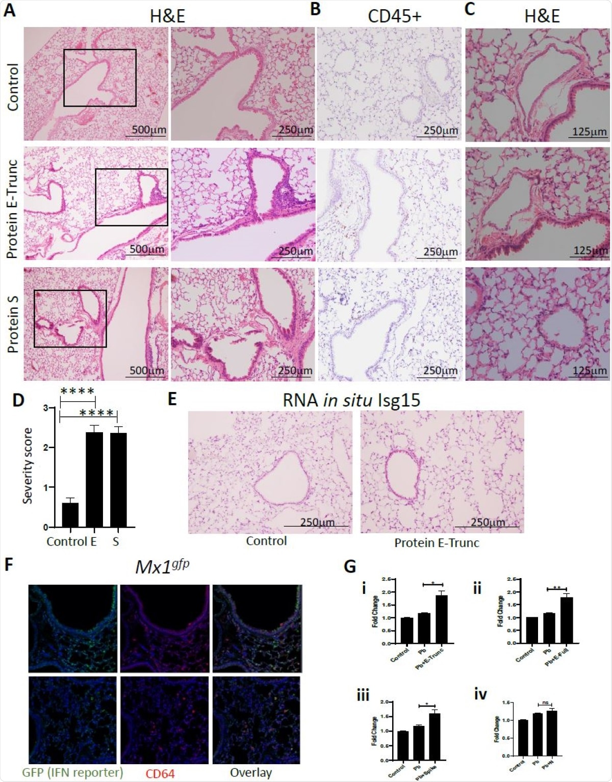 SARS-CoV-2 Protein E Induces Lung Inflammation and Vasculitis in Mice. (A) Representative images of lung cross-sections from mice after intranasal delivery of control or 10µg of E-Trunc and S. H+E stained sections are shown. Boxed areas on the left are magnified to the right. (B) Representative images of the lung cross-sections immunostained for CD45 expression. (C) Representative images of lung cross-sections focused on blood vessels in the above conditions. Scale bars depicted in each picture. (D) Quantification of percent of lobes with inflammatory infiltrates in lungs harvested in the above conditions. (n=3 mice per condition). (E) Representative images of the lung cross-sections stained for Isg15 by RNA in situ (n=3 mice per condition). (F) Representative immunofluorescent images of the lung cross-sections immunostained for GFP and CD64 expression 3 days after intranasal delivery of 10ug of E or control (n=2 mice). (G) Fold change in IFN reporter activities in A549 cells with treated with control, Pb at 10µg/ml and SARS-CoV-2 proteins (E-Trunc (i), E-Full length (ii), S (iii), N (iv)) individually at 2µg/ml with Pb at 10µg/ml for 24 hours. (n=2 experiments; 6 biological and 9-21 technical replicates with all proteins). Graphs depict average with SEM. *p<0.05 ,**p<0.01, ****p<0.0001 and ns denotes not statistically significant. Mann-Whitney used for statistical analysis.