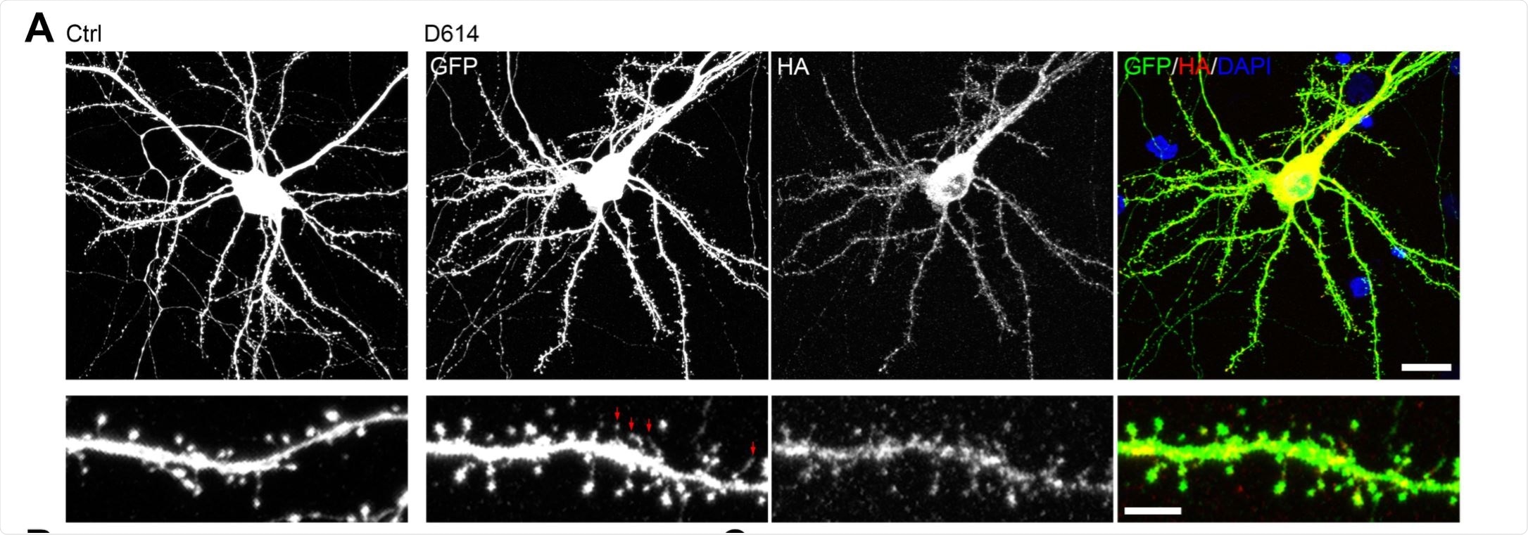 Overexpression of SARS2 spike protein alters the density and morphology of dendritic spines of cultured neurons. (