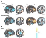 Changes in consciousness linked to the same brain network for sleep and anesthesia