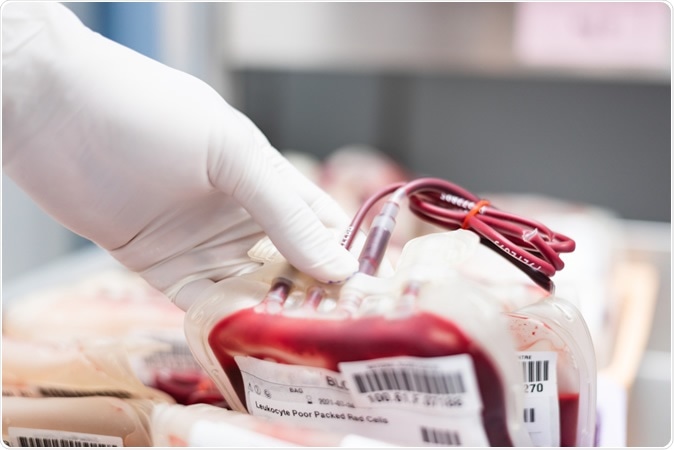 Blood plasma. Image Credit: Komsan Loonprom / Shutterstock