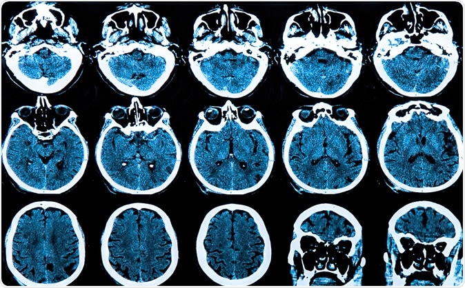 Image Credit: Photoprofi30 / Shutterstock