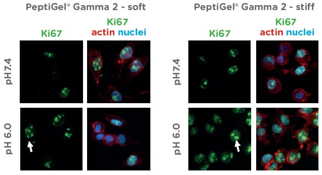 Peptigel Hydrogels Mimic Healthy and Tumor Tissue Properties