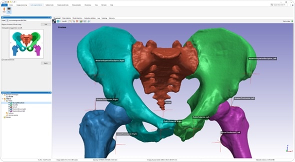 Synopsys introduces automated segmentation tool for hips and knees Synopsys introduces automated segmentation tool for hips and knees