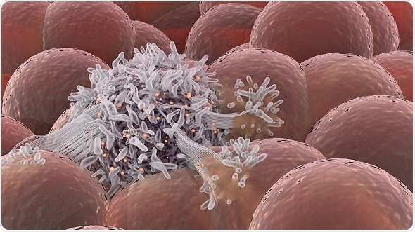 New 3D model shows how breast cancer cells interact with the body’s stem cells