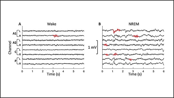 Sleep spindles in sheep could provide clues to human brain disorders Sleep spindles in sheep could provide clues to human brain disorders