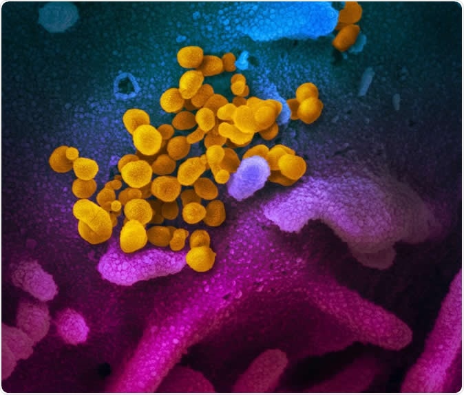This scanning electron microscope image shows SARS-CoV-2 (yellow)—also known as 2019-nCoV, the virus that causes COVID-19—isolated from a patient in the U.S., emerging from the surface of cells (blue/pink) cultured in the lab. NIAID-RML