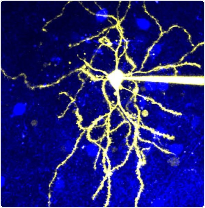 Microscopic image of a neuron that expresses D2R. Image Credit: © 2020 Yagishita et al.