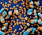 Eleventh global case of SARS-linked virus confirmed in U.K.