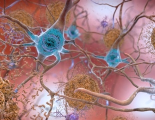 MIT researchers map dynamic fuzzy coat surrounding tau protein fibrils