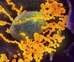 Coronavirus able to survive near boiling point of water, study shows