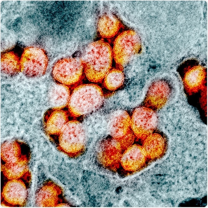 Novel Coronavirus SARS-CoV-2 Transmission electron micrograph of SARS-CoV-2 virus particles, isolated from a patient. Image captured and color-enhanced at the NIAID Integrated Research Facility (IRF) in Fort Detrick, Maryland. Credit: NIAID