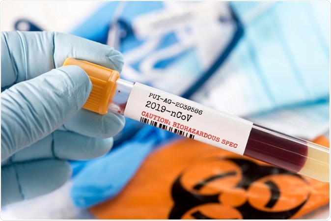 Study: The FDA-approved gold drug Auranofin inhibits novel coronavirus (SARS-COV-2) replication and attenuates inflammation in human cells. Image Credit: Sherry Yates Young / Shutterstock