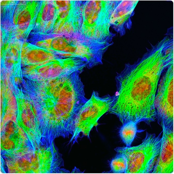 Fluorescence Microscopy
