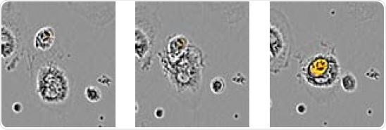 Kinetic Analysis of Microglial Function and Morphology
