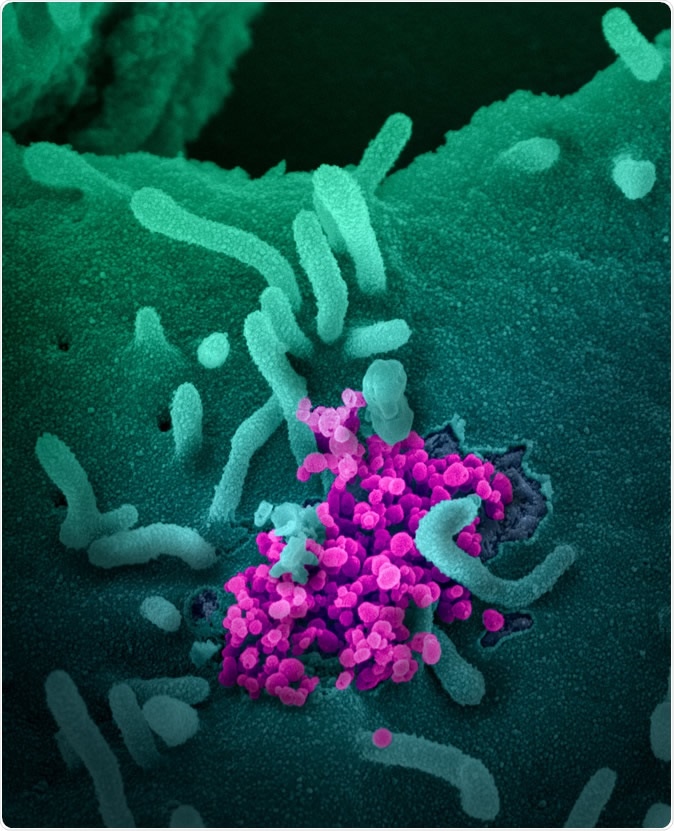Novel Coronavirus SARS-CoV-2 This scanning electron microscope image shows SARS-CoV-2 (round magenta objects) emerging from the surface of cells cultured in the lab. SARS-CoV-2, also known as 2019-nCoV, is the virus that causes COVID-19. The virus shown was isolated from a patient in the U.S. Image captured and colorized at NIAID