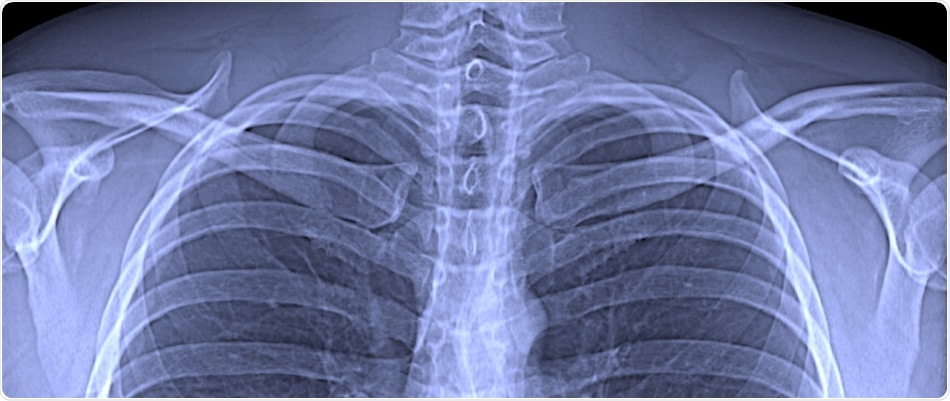 TUM researchers develop innovative x-ray method for lung diagnostics