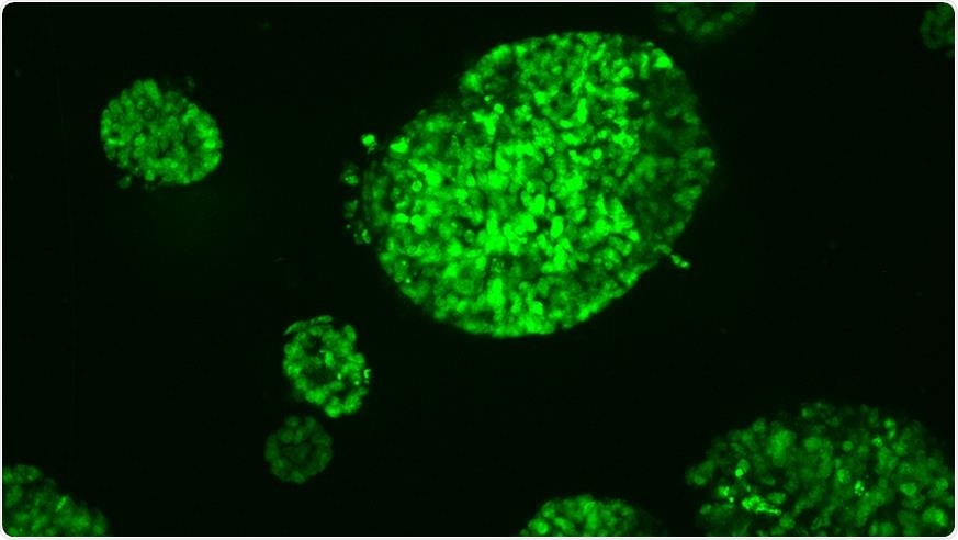 Mini tumours grown from a bowel cancer. Image Credit: The Institute of Cancer Research