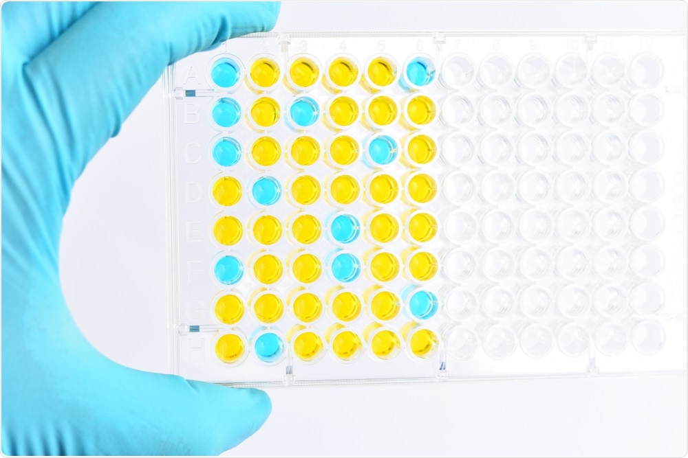Enzyme-linked immunosorbent assay or ELISA plate, Immunology testing method in laboratory. Image Credit: Jarun Ontakrai / Shutterstock