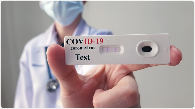 Coronavirus Antibody Test