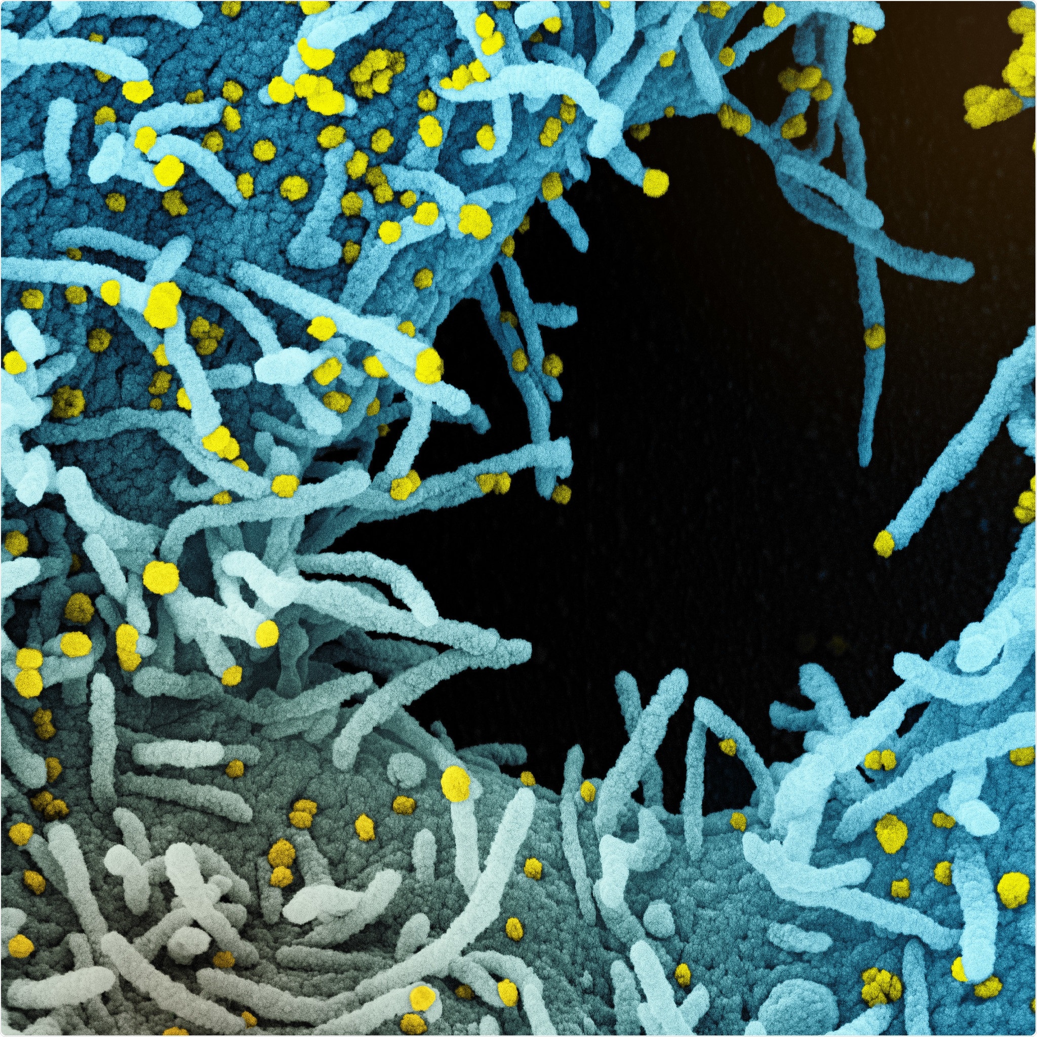 Novel Coronavirus SARS-CoV-2 Colorized scanning electron micrograph of a cell heavily infected with SARS-CoV-2 virus particles (yellow), isolated from a patient sample. The black area in the image is extracellular space between the cells. Image captured at the NIAID Integrated Research Facility (IRF) in Fort Detrick, Maryland. Credit: NIAID