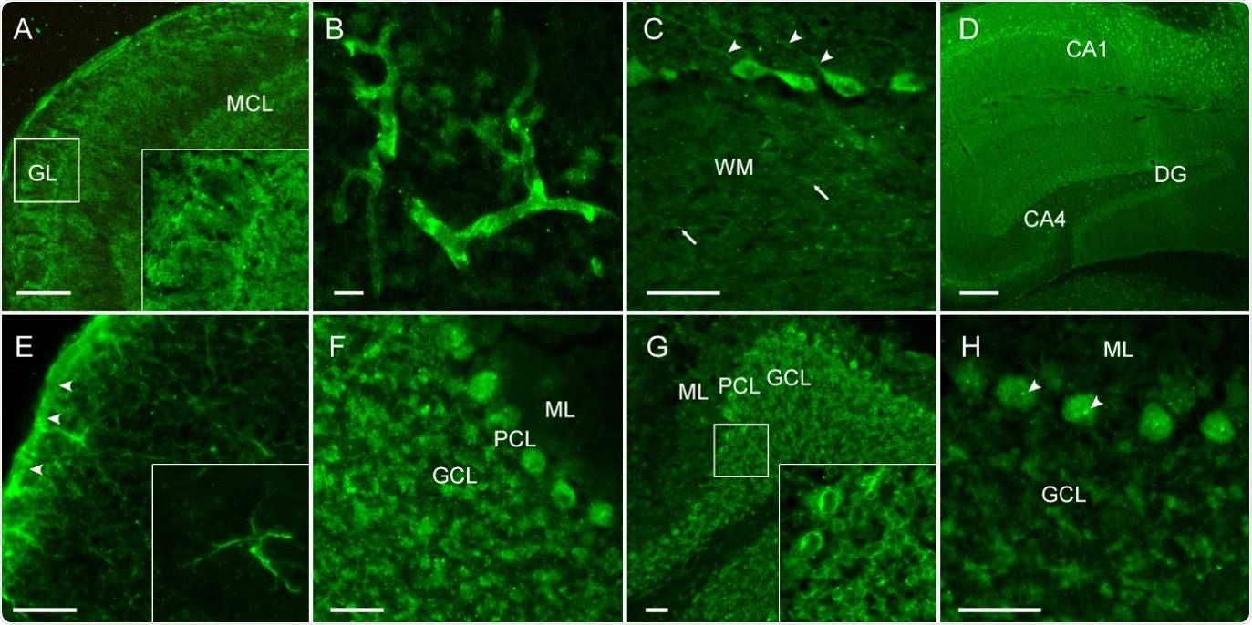 CSF of COVID-19 patients shows strong IgG autoreactivity on unfixed mouse brain sections. Representative images of indirect immunofluorescence demonstrate autoantibody binding to circumscribed anatomical structures including (A) neuropil of the olfactory bulb, (B) medium-sized vessels in the brain, (C) proximal dendrites of Purkinje neurons (arrowheads) and myelinated fibers (arrows) in the cerebellum, (D) neuropil in the hippocampus, (E) glia limitans (arrowheads) and astrocytes (enlarged box) throughout the brain. Several autoantibodies target intracellular antigens, such as (F) densely clustered intraneuronal epitopes, (G) perinuclear antigens or (H) nucleoli (arrowheads) as part of an anti-nuclear antibody response.