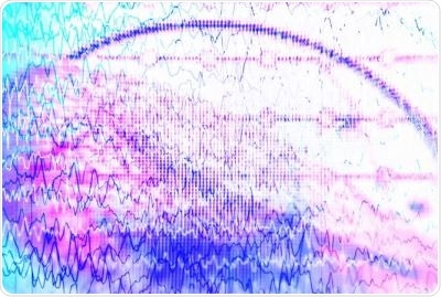 Psychogenic non-epileptic seizures are often misdiagnosed as epilepsy and increase risk of death