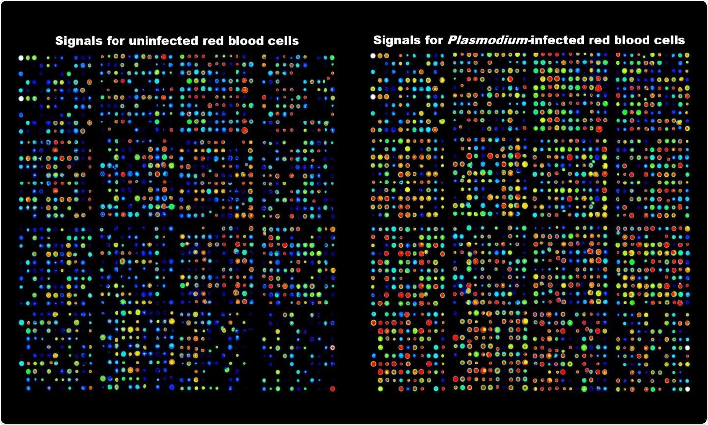 Antibody array data showing activation of kinases in human red blood cells infected with the malaria parasite.  CREDIT RMIT University