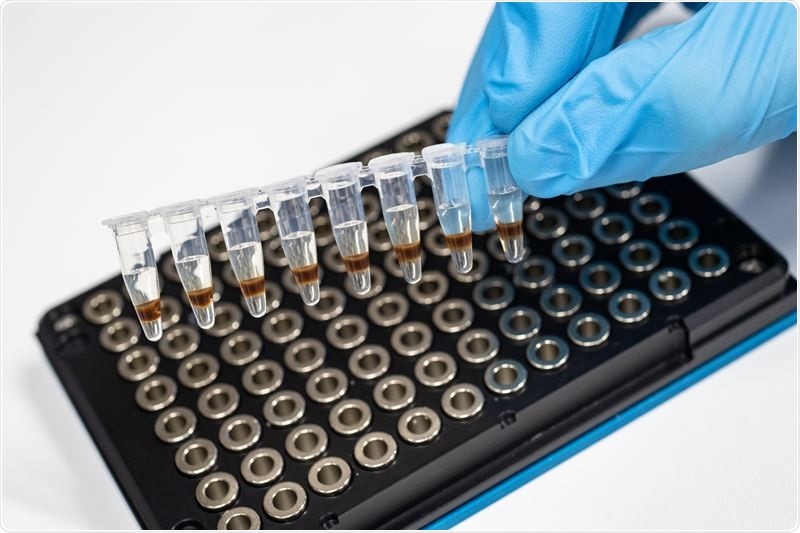 Diabetes blood markers linked to Alzheimer’s disease pathology, shows study