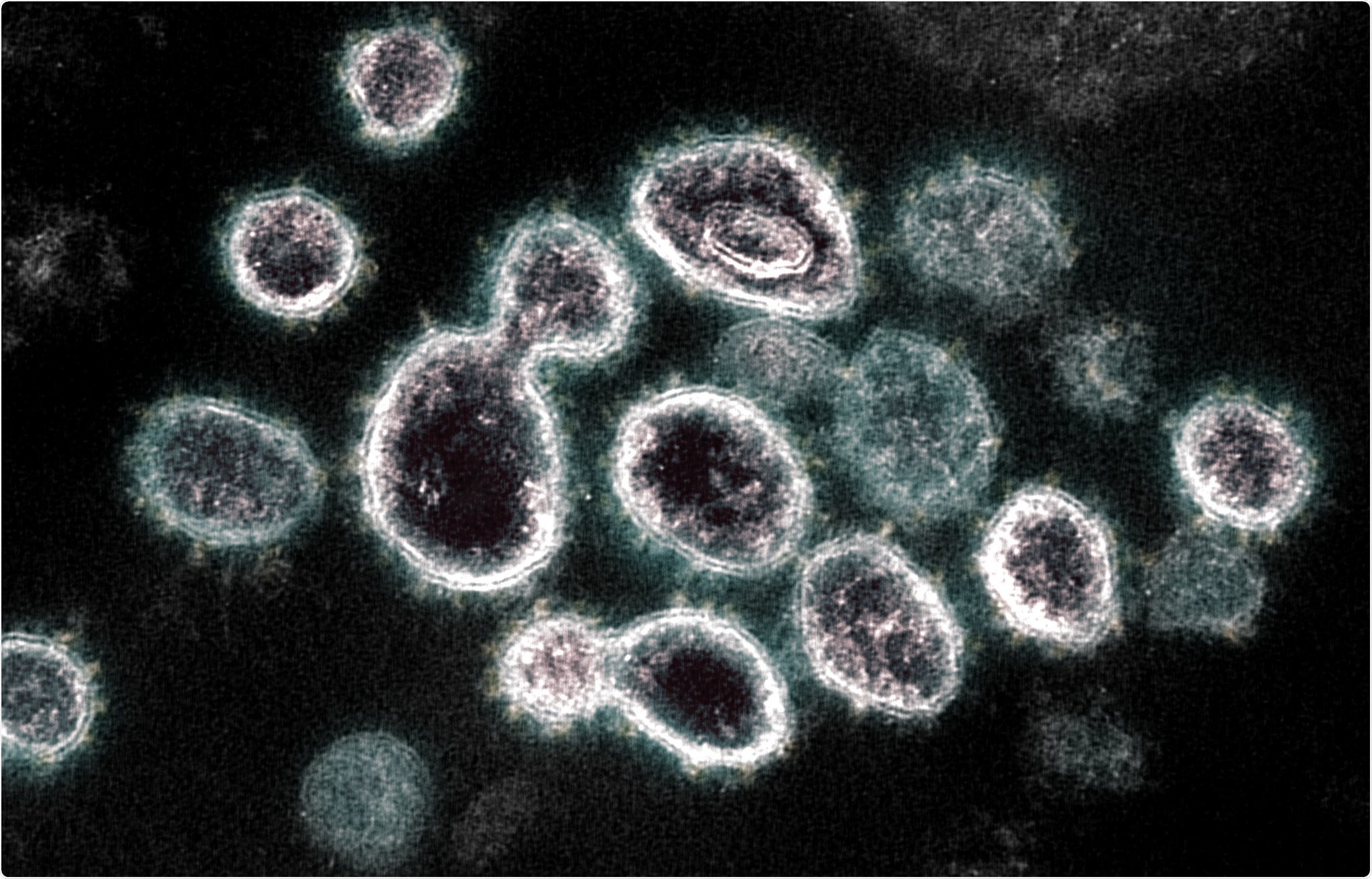 This transmission electron microscope image shows SARS-CoV-2, the virus that causes COVID-19, isolated from a patient in the U.S. Virus particles are shown emerging from the surface of cells cultured in the lab. The spikes on the outer edge of the virus particles give coronaviruses their name, crown-like. Image captured and colorized at NIAID