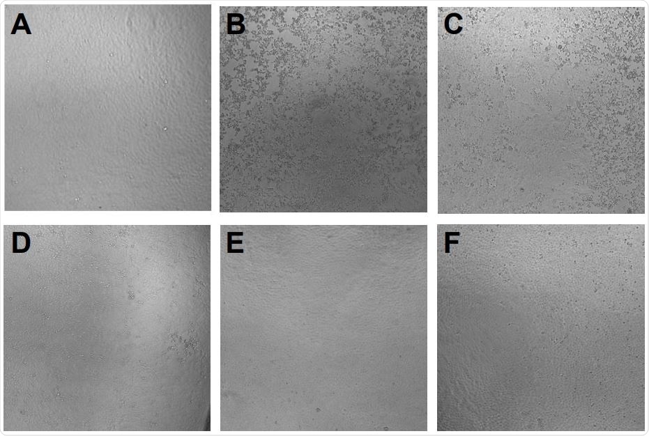 Prevention of SARS-CoV-2 induced cytopathic effect by azelastine. Vero E6 cells were infected with SARS-CoV-2 simultaneously with the addition of 0·4 to 25 µM of azelastine and continued to be cultured without the virus in the presence of the respective concentrations of the drugs. Cytopathic effect was assessed by light field microscopic examination of cultures 48 hours postinfection. A: uninfected (negative) control, B: virus infected (positive) control, C: virus + 3·125 µM azelastine, D: virus + 6·25 µM azelastine, E: virus + 12·5 µM azelastine, F: virus + 25 µM azelastine. G: Scoring system and summary of cytopathic effect in the presence of azelastine (results of two independent experiments).